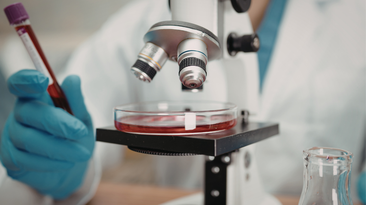 Live blood microscopy analysis at Eden Longevity Center Ubud Bali